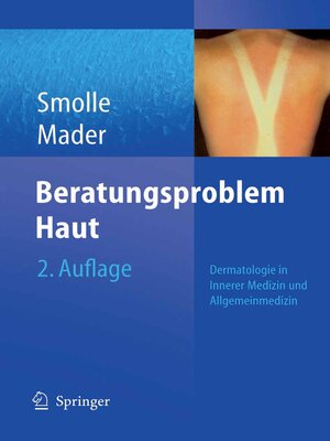 cover image of Beratungsproblem Haut